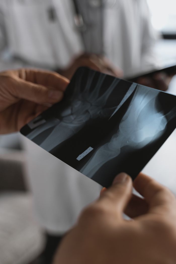 Home Close-up of hands holding an X-ray image in a medical environment with healthcare professionals.
