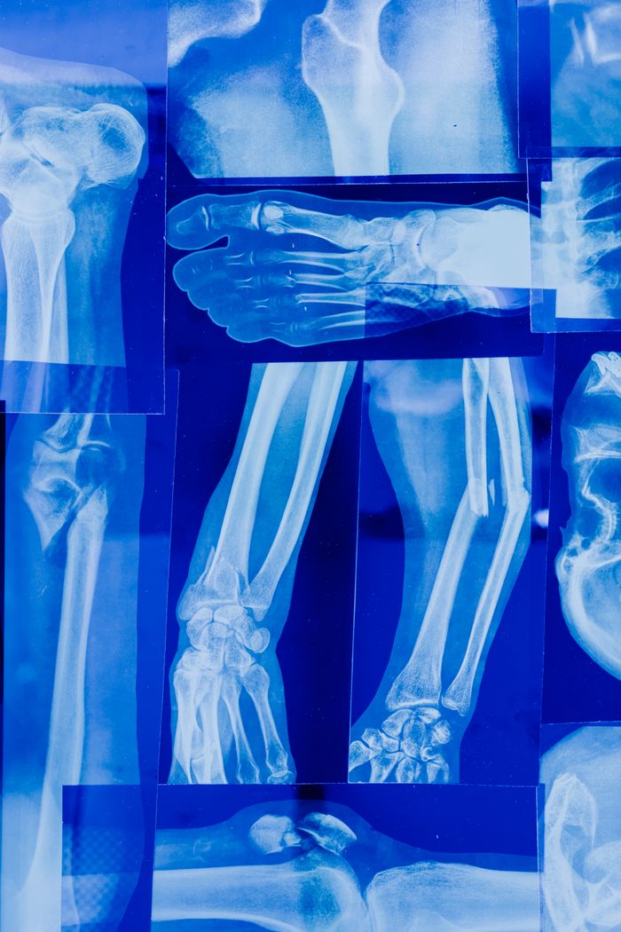 Home Detailed collage of human bone x-rays illustrating various skeletal parts in blue tonality.